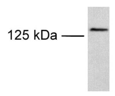 Western Blot of transfected COS cells showing specific immunolabeling of TRPM8.