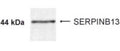Western Blot of 5 ug of normal oral mucosa lysate showing specific immunolabeling of SERPINB13. 