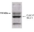 Western Blot of 100 ug of formic acid extracts of Alzheimer diseased brain showing specific immunolabeling of Collagen XXV.