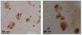 Immunohistochemistry of the neocortex of Alzheimer's diseased brain sections (floating, fixed with 10% formalin for 24 hrs) showing specific staining of Collagen XXV. 