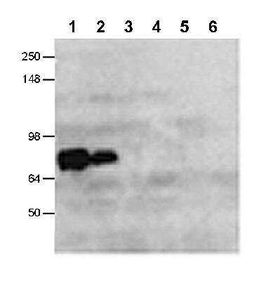 Western Blot of Lane 1: full-length CLAC-P (lysate), Lane 2: secreted form of CLAC-P (media), Lane 3: COLXIII (lysate), Lane 4 degrees COLXIII (media), Lane 5: COLXXIII (lysate), Lane 6: COLXXIII (media) showing specific immunolabeling of Collagen XXV alpha 1.  