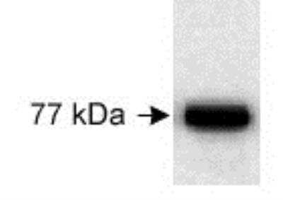 Western Blot of 20 ug of human lung adenocarcinoma cell line NCI-H322 lysate showing specific immunolabeling of Kindlin.