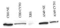 Immunoprecipitation of Ku80 in either CHO or A549 nuclear extracts (NE) or cytoplasmic lysates (cyto). A Ku80 deficient cell lysate, XRS, was used as a negative control.
