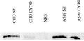 Immunoprecipitation showing detection of Ku80 in either CHO or A549 nuclear extracts (NE) or cytoplasmic lysates (cyto). A Ku80 deficient cell lysate, XRS, was used as a negative control.