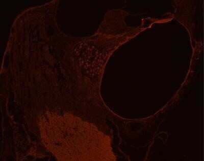 Immunohistochemistry of mouse inner ear frozen sections showing specific staining of GLUT10 at 1:200 dilution. Sections were incubated with secondary (anti-rabbit Cy3, 1:400) RT 1 hr. Slides mounted with fluoromont G and examined under a confocal microscope. Strong immunoreactivity (red) is observed in the inner and outer hair cells and basilar membrane. Spiral ganglion neurons display moderate staining.