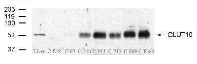 Western Blot showing specific immunolabeling of GLUT10 in Lane 1: 10ug of protein from liver  Lane 2: 10ug of protein from cochlea (E18) Lane 3: 10ug of protein from cochlea (P7)  Lane 4: 10ug of protein from cochlea (P10)  Lane 5: 10ug of protein from cochlea (P14)  Lane 6: 10ug of protein from cochlea (P17)  Lane 7: 10ug of protein from cochlea (P60)  Lane 8: 10ug of protein from cochlea (1 Year).