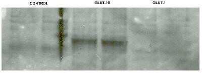 Western Blot of NCI-H1299 non-small cell lung tumor cells transfected with the eukaryotic expression vectors pcDNA3.1/V5 (lanes 1,2), pCMV-GLUT10 (lanes 3,4), and pCMV-GLUT1 (lanes 5,6) showing specific immunolabeling of GLUT10.