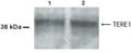 Western Blot of 30 ug of normal human bladder mucosa (lane 1) and urothelial carcinoma (lane 2) showing specific immunolabeling of TERE1.