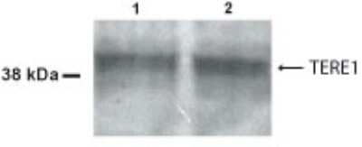 Western Blot of 30 ug of normal human bladder mucosa (lane 1) and urothelial carcinoma (lane 2) showing specific immunolabeling of TERE1.