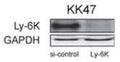 Western Blot showing specific immunolabeling of Ly-6K in KK47 human bladder carcinoma cells, LY-6K siRNA, but not scrambled siRNA knocked down Ly-6K expression. A GAPDH antibody was used as a protein loading control. Data courtesy of Masuda et al.