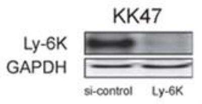 Western Blot showing specific immunolabeling of Ly-6K in KK47 human bladder carcinoma cells, LY-6K siRNA, but not scrambled siRNA knocked down Ly-6K expression. A GAPDH antibody was used as a protein loading control. Data courtesy of Masuda et al.
