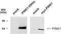 Western Blot of C-terminally V5His-tagged human PINK1 or N-terminally myc-tagged human PINK1 expressed in HEK293T cells showing specific immunolabeling of PINK1.