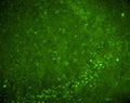 Immunohistochemistry of adult rat brain hippocampus showing specific staining of Nurr1. Tissue was fixed in paraformaldehyde and cut into 20 micron sections.