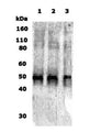 Western Blot of 10ug of human brain lysate (lane 1), rat brain lysate (lane 2) and mouse brain lysate (lane 3) showing specific immunolabeling of Delta Opioid Receptor. 