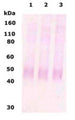 Western Blot of 10 ug of human brain lysate (lane 1), rat brain lysate (lane 2) and mouse brain lysate (lane 3) showing specific immunolabeling of MOR-1.