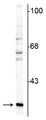 Western blot of rat cerebellar lysate showing specific immunolabeling of the ~29 kDa calretinin protein. 