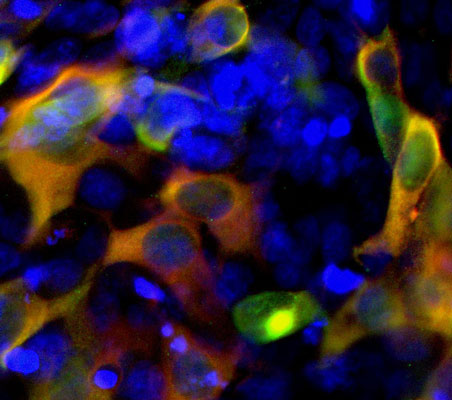 Immunofluorescence of HEK293 cells transfected with a fusion construct of GFP with the C-terminal region of S. aureas Cas9 protein (green) that is labeled with Anti-CRISPR Cas9 (cat. 304-Cas9, 1:1000, red)and the DNA stained blue with DAPI. The yellow label is the overlapping of the Anti-Cas9 antibody and the Cas9-GFP construct.