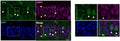 Representative images of CA1 region of mouse hippocampus. White arrows indicate cFos+ cells (Cat. 309-cFOS), yellow arrows indicate 53BP1 + cells. Nuclei stained with DAPI (blue). Right: zoomed images of the white boxes. Image from publication CC-BY-4.0.