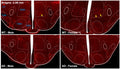 Immunofluorescence of young male and female wild type (WT) and Alzheimer's Disease (AD) mouse brain labelling nucleus-specific c-Fos + cells in the DMH, VMH, ARH, TuN, and LH regions.  Image from publication CC-BY-4.0. PMID: 39272160
