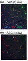 (A, B) confocal microscope images showing PV, WFA, and c-Fos (Cat. 309-cFOS) staining after vehicle or ABC treatment in the prelimbic PFC after vehicle or ABC 31 days later. White arrows indicate triple-labelled
