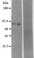 Western blot detection of Neprilysin using Anti-Neprilysin Antibody (Neutral Endopeptidase - Nep) (Cat. 310-CD10). Gel was loaded with Rat kidney Lane 1) membrane fraction, lane 2) purified enzyme and lane 3) pre-immune serum. Proteins were transferred to the PVDF membrane, blocked, and then washed with a buffer. Primary antibody was incubated with sample and then detected via chemiluminescence using a secondary antibody.
