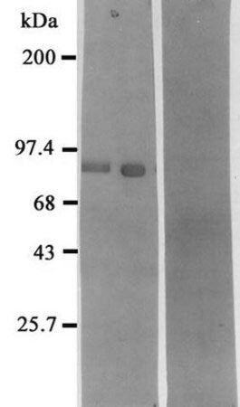 Western blot detection of Neprilysin using Anti-Neprilysin Antibody (Neutral Endopeptidase - Nep) (Cat. 310-CD10). Gel was loaded with Rat kidney Lane 1) membrane fraction, lane 2) purified enzyme and lane 3) pre-immune serum. Proteins were transferred to the PVDF membrane, blocked, and then washed with a buffer. Primary antibody was incubated with sample and then detected via chemiluminescence using a secondary antibody.