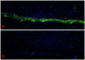 Immunofluorescent staining of Calcitonin Gene Related Peptide (CGRP) in the spinal trigeminal nucleus of the rat brainstem using PhosphoSolutions anti-CGRP mouse monoclonal antibody (Cat No. 311-CGRP). The sections of formalin fixed, paraffin rat brain tissue were blocked with Immuno Protein Blocking Solution with 5% Goat Serum (AR-6591-04). In image A, the anti-CGRP antibody (Cat No. 311-CGRP) was incubated with the sample at a dilution of 1:500 (2 ug/mL) at 4°C overnight. Image B depicts the absence of staining in a secondary only control. After washing with TBST, the tissues were stained using goat anti-mouse Alexa Fluor 488 (green). The tissues were mounted with Antibodies Incorporated Fluoroshield with DAPI and DABCO mounting medium (Cat No. AR-6505). DAPI nuclear stain (blue) shows cell nuclei. Magnification 100X.