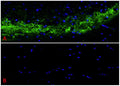 Immunofluorescent staining of Calcitonin Gene Related Peptide (CGRP) in the spinal trigeminal nucleus of the rat brainstem using PhosphoSolutions anti-CGRP mouse monoclonal antibody (Cat No. 311-CGRP). The sections of formalin fixed, paraffin rat brain tissue were blocked with Immuno Protein Blocking Solution with 5% Goat Serum (AR-6591-04). In image A, the anti-CGRP antibody (Cat No. 311-CGRP) was incubated with the sample at a dilution of 1:500 (2 ug/mL) at 4°C overnight. Image B depicts the absence of staining in secondary only control. After washing with TBST, the tissues were stained using goat anti-mouse Alexa Fluor 488 (green). The tissues were mounted with Antibodies Incorporated Fluoroshield with DAPI and DABCO mounting medium (Cat No. AR-6505). DAPI nuclear stain (blue) shows cell nuclei. Magnification 400X.