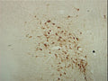 Immunostaining of rat brainstem showing specific labeling using our anti-ChAT antibody. Image courtesy of Dr. Robert Sloviter, University of Arizona.