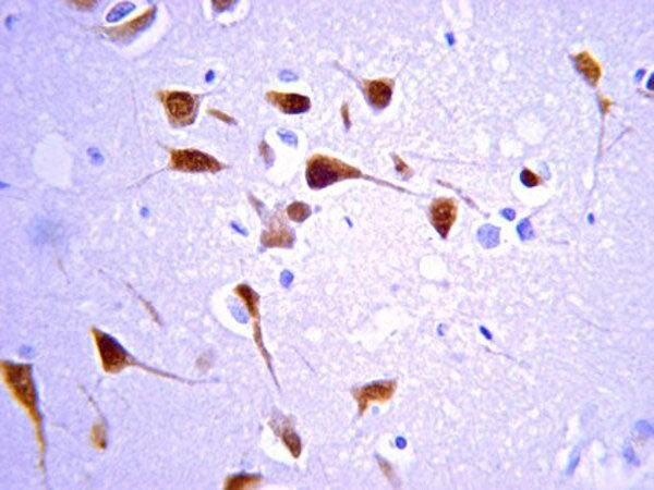 Immunohistochemistry detection of ChAT in normal cerebral cortex tissue using Anti-Choline Acetyltransferase (ChAT) Antibody (Cat. 316-ChAT). Tissue was mounted and pariffin fixed. Heat induced antigen retrieval was performed using citrate buffer, heated, and then blocked. After washing, the primary antibody (Cat. 316-ChAT) was incubated with the sample at 1:100. Immunoreactivity is seeing as a staining pattern on the cell body, dendrites and axons of neurons.