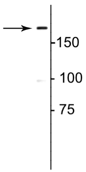 Western blot of rat lung lysate showing specific immunolabeling of the ~180 kDa collagen 1.
