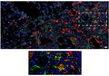 Immunolabeling of Pro-Col1a1 (Cat. 321, COLP, green), a Ct2-cluster marker, showing colocalization with tdTom+ cells from mouse lungs. Image from publication. CC-BY-4.0 PMID:
