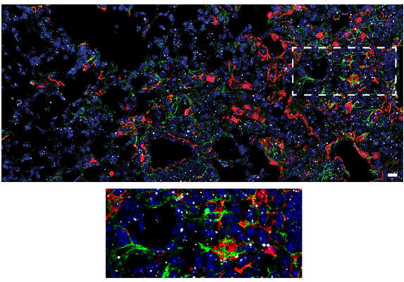 Immunolabeling of Pro-Col1a1 (Cat no 321, COLP, green), a Ct2-cluster marker, showing colocalization with tdTom+ cells from mouse lungs.  Image from publication. CC-BY-4.0 PMID: 39945330.