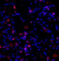Immunostaining of fibrotic mouse lung tissue showing specific staining of collagen I molecules (Cat. 621-COLP, 1:100, red) that are still associated with the cells in which they were synthesized. The blue is staining DNA.