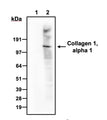 Western blot detection of collagen 1, alpha 1 telopeptide in mouse lung (lane 1, high expression) and HaCaT (lane 2, low expression/negative control) lysates using PhosphoSolutions anti-Collagen 1, alpha 1 telopeptide rabbit polyclonal antibody (Cat No. 322-COLT). 4-12% Bis-Tris gel was loaded with 15 µg of mouse lung and NIH3T3 lysates. Proteins were transferred to PVDF membrane and blocked with 5% non-fat milk powder. Anti-COL1A1 rabbit (Cat No. 322-COLT) (lanes 1, 2) antibodies were incubated with the membrane at a concentration of 1:1000. The primary antibodies were then detected via chemiluminescence (40 seconds) using a goat anti-Rabbit H+L, HRP conjugated secondary antibody. Anti-COL1A1 antibodies recognize collagen 1, alpha 1 found in lung lysates at ~140 kDa and an absence in signal in HaCaT cell lysate, consistent with low endogenous expression levels.