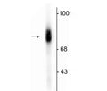 Western blot of human adrenal medulla lysate showing specific immunolabeling of the ~75 kDa DBH protein.