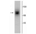 Western blot of human striatal lysate showing specific immunolabeling of the ~88 kDa DAT protein.