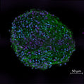 Cell Line: human-derived iPSC cerebral organoids. Neurofilament-H (green), NeuN (purple), DAPI (turquoise). Image courtesy of Caroline Krall, Johns Hopkins University