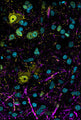 Cell Line: human-derived iPSC cerebral organoids. MAP2 (pink), NeuN (yellow), DAPI (turquoise). Image courtesy of Caroline Krall, Johns Hopkins University