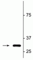 Western blot of colchicine treated Sy5y cell lysate showing specific immunolabeling of the ~32 kDa cleaved actin fragment (fractin). 