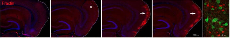 Fractin (cat. 592-FRAC, 1:5000; red) immunostaining of mouse brain signifying the emergence of damaged/dying neurons in entorhinal cortex (EC). Nuclei stained with DAPI (blue). Final image shows fractin+ cells (red) among YFP+ cells (green) at 7 dpi. Image from publication CC-BY-4.0. PMID:36468693