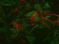 Immunolabeling of mouse hippocampal cultures labeled with Anti-GFAP (Cat. 620-GFAP, 1:1000, green) and anti-MAP2 (1100-MAP2, 1:1000, red).