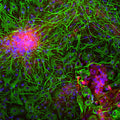 Immunolabeling of E20 rat mixed neuron and glial cultured cells labeled with anti-neuron specific enolase antibody (Cat. 1520-NSE, red, 1:500) and anti-GFAP antibody (Cat. 621-GFAP, green, 1:5000). The blue is Hoechst stain of nuclear DNA. Anti-NSE labels protein expressed in neuronal cells and anti-GFAP labels