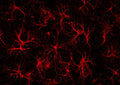 Immunofluorescence of a section of mouse prefrontal cortex labeled with Anti-GFAP (Cat. 621-GFAP, red, 1:1000). Image courtesy Andrea Cardenas, Rosalind Franklin Unversity, Medicine and Science.
