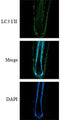 Immunolabeling of an organ cultured human hair follicle treated with 1.25ug/ml of ICP5249 for 5 days labeling light chain 3 I/II (green) and DAPI (Cat. 6244, blue) was used for nuclear staining. Image from publication. CC-BY-4.0 PMID: 39155393
