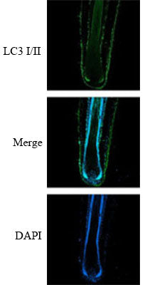 Immunolabeling of an organ cultured human hair follicle treated with 1.25ug/ml of ICP5249 for 5 days labeling light chain 3 I/II (green)  and DAPI (Cat No 6244, blue) was used for nuclear staining. Image from publication. CC-BY-4.0 PMID: 39155393