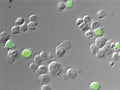 Figure 2. Jurkat cells were exposed to 3% formaldehyde for 30 minutes. Following the formaldhehyde treatment, cells were stained with Green Live/ Dead stain and then imaged with a Nikon E800 microscope (DIC overlay shown). Cells with compromised membranes stained green, while cells with intact membranes excluded the Green Live/Dead stain and remained unstained. Data courtesy of Mrs. Tracy Murphy, ICT.