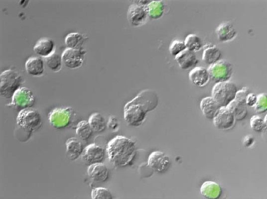 Figure 2. Jurkat cells were exposed to 3% formaldehyde for 30 minutes. Following the formaldhehyde treatment, cells were stained with Green Live/ Dead stain and then imaged with a Nikon E800 microscope (DIC overlay shown). Cells with compromised membranes stained green, while cells with intact membranes excluded the Green Live/Dead stain and remained unstained. Data courtesy of Mrs. Tracy Murphy, ICT.