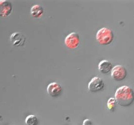 Figure 5. Green Live/Dead Stain and FLICA® 660 Poly Caspase detection reagent (Cat. 9120) were used to assess cell death in staurosporine-treated Jurkat cells. Cells were imaged with a Nikon E800 microscope. The majority of cells were in the early stages of apoptosis (active caspases stained red with FLICA® 660). One cell in this field of view (bottom right corner) exhibited both red and green fluorescence, indicating the loss of membrane integrity, characteristic of late-stage apoptosis.