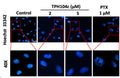 Representative images of BT-20 cells with vehicle (0 μM), 2, or 5 μM of TPH104c for 24 h or paclitaxel (PTX, 1 μM, a positive control) and stained with Hoechst 33342 dye (Cat. 639). TPH104c did not produce condensed or fragmented nuclei compared to cells incubated with paclitaxel (PTX). Scale bar = 25 μM.